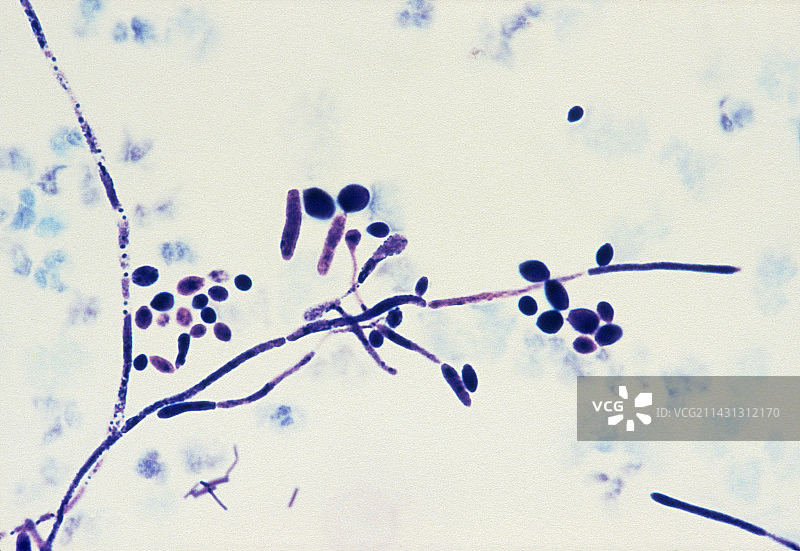 尿液样本中发现的念珠菌LM图片素材