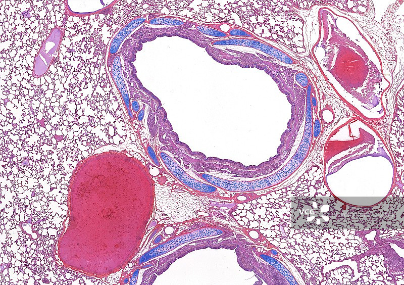肺部显微照片图片素材