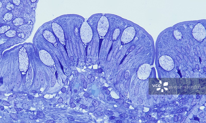 人肠道显微照片图片素材