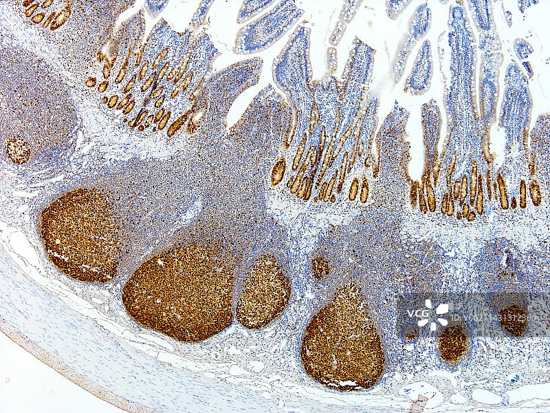 肠道淋巴组织图片素材