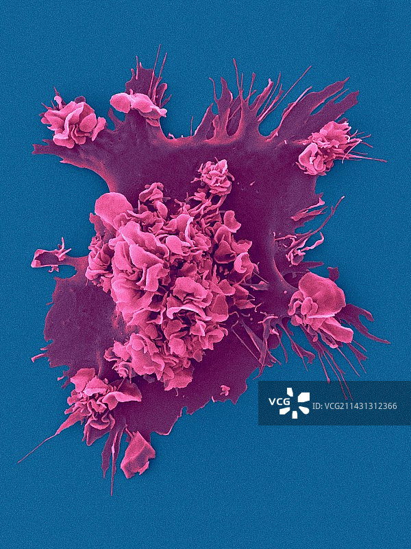 人类树突状细胞，扫描电镜图图片素材