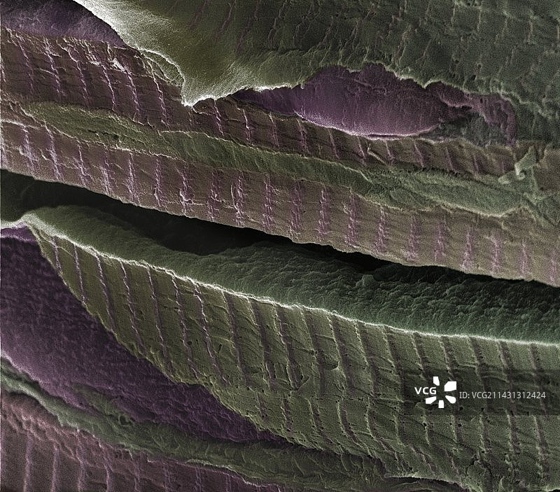 心肌扫描电镜图图片素材