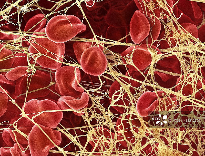 血栓扫描电镜图片素材