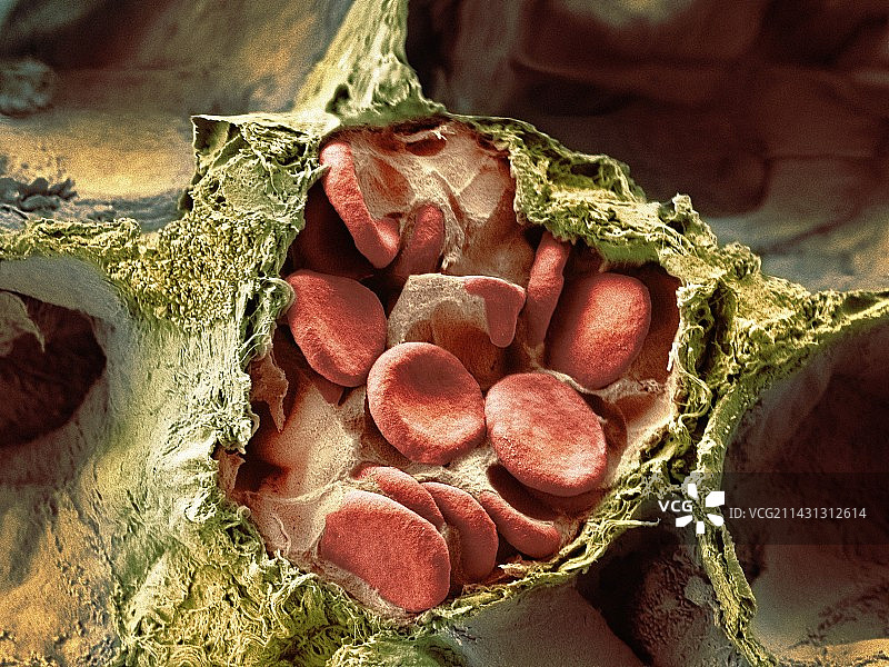 肺组织中的血管和肺泡图片素材