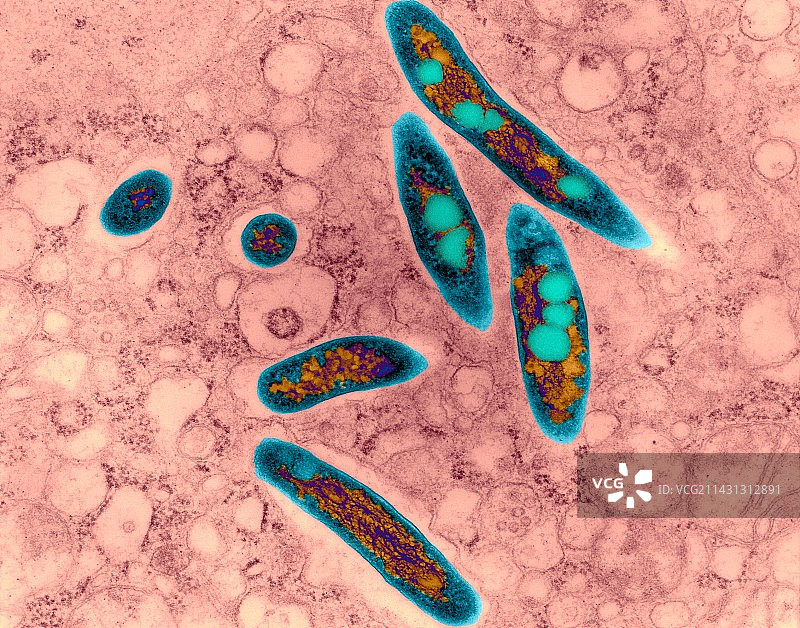 鸟分枝杆菌肺部感染，TEM图片素材