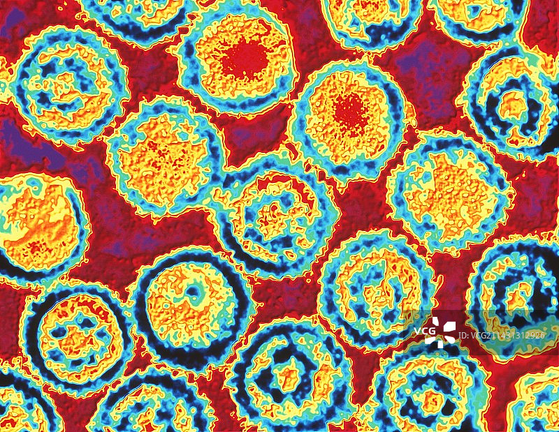 EB病毒的彩色透射电子显微镜图像图片素材