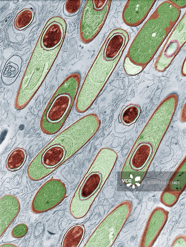 炭疽杆菌，透射电镜图片素材
