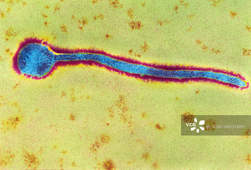 马尔堡病毒的彩色透射电子显微镜图像图片素材