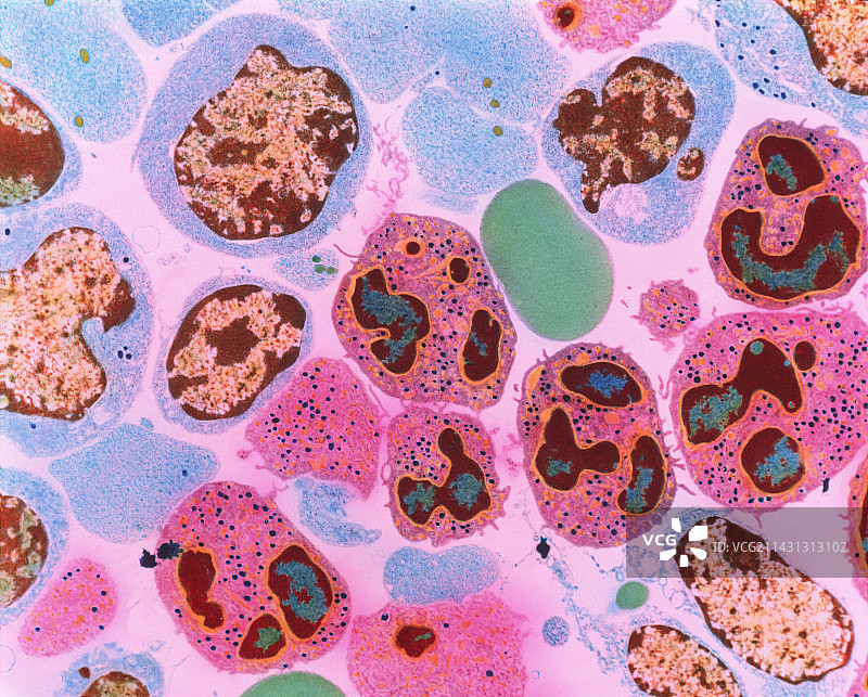 骨髓细胞切片的透射电镜照片图片素材