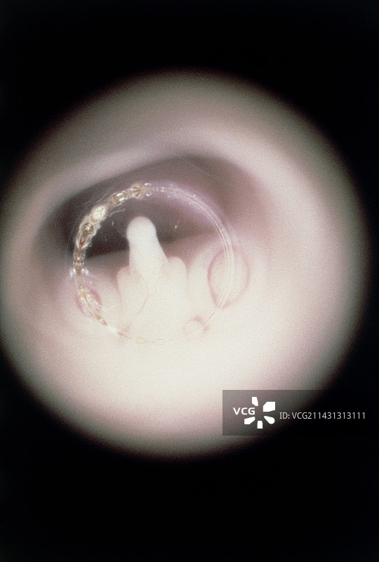 人类胎儿生殖器图片素材