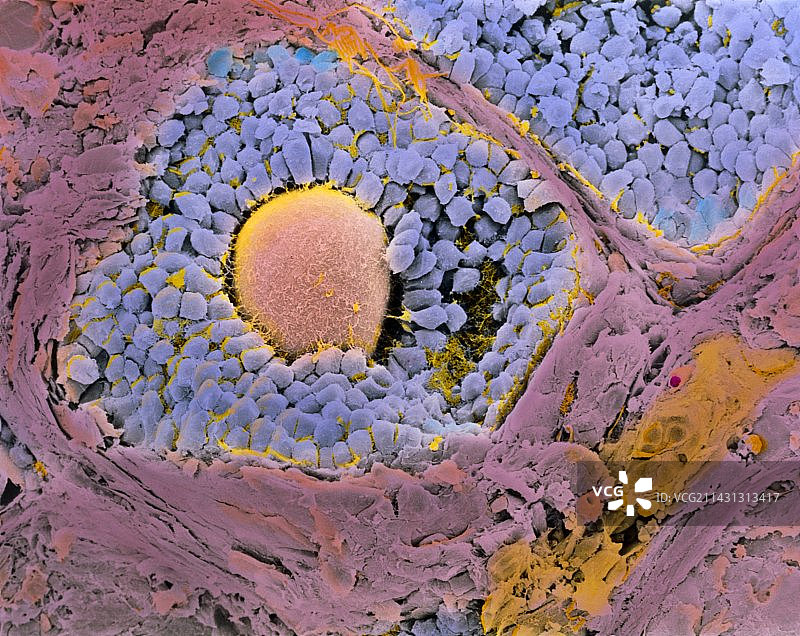 卵巢次级卵泡的彩色扫描电镜图图片素材