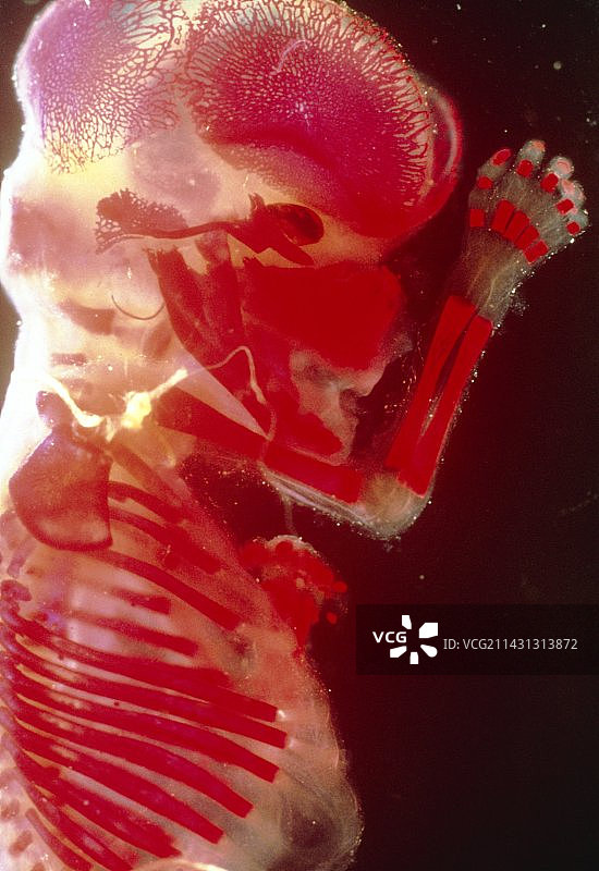 染色骨骼的12周大的人类胎儿图片素材