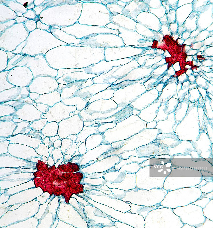 梨果石细胞显微照片图片素材