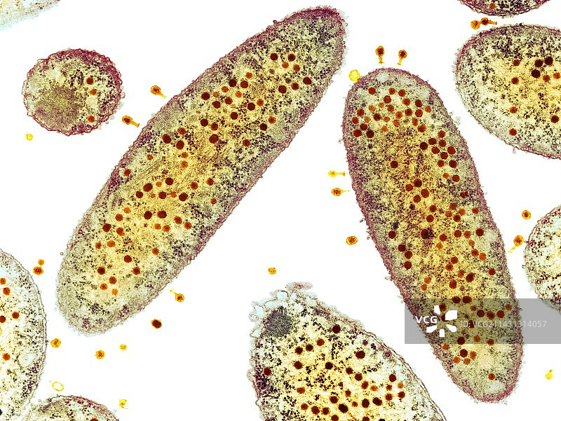 噬菌体感染大肠杆菌细胞（透射电子显微镜）图片素材