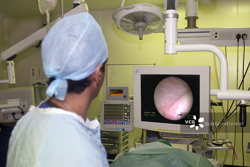 内窥镜检查图片素材