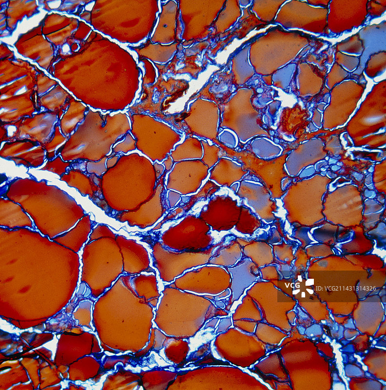 人体甲状腺显微图像图片素材