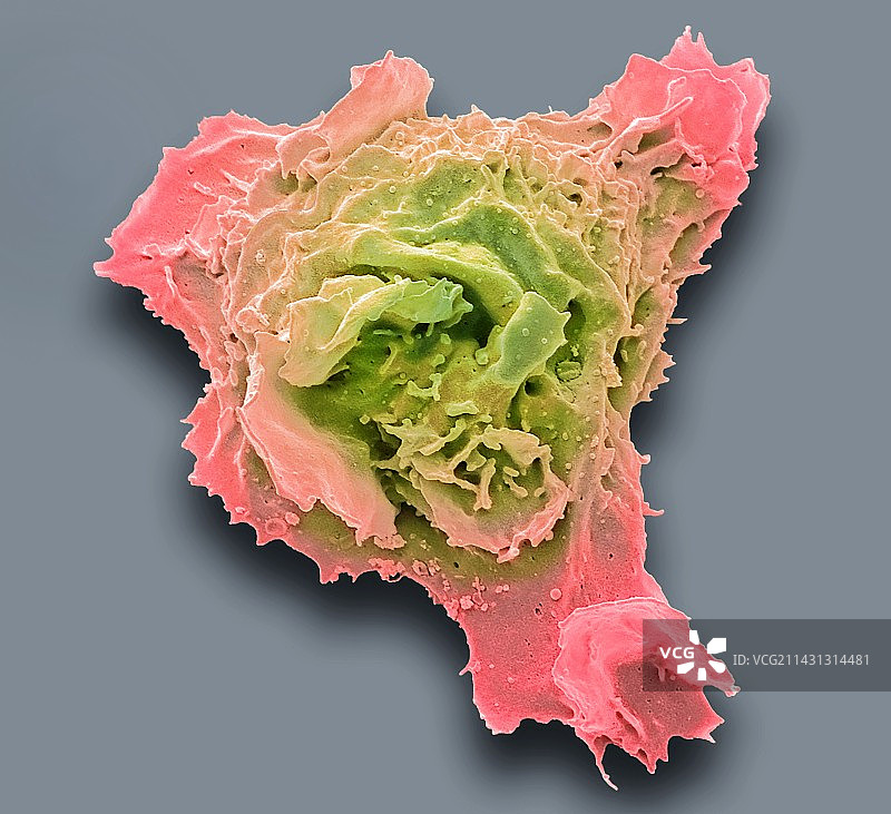 白血病细胞扫描电镜图图片素材