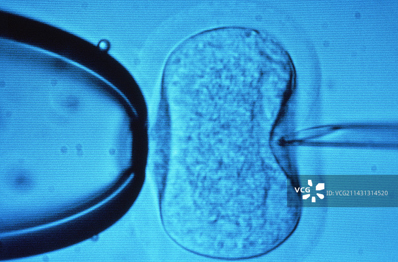 体外受精图片素材