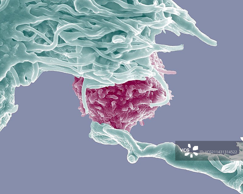 树突状细胞和淋巴细胞扫描电镜图图片素材