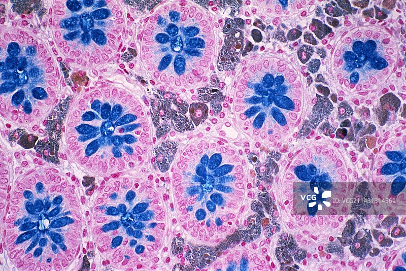 结肠黑变病，光学显微照片图片素材