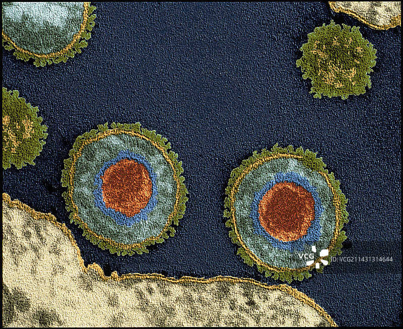 单纯疱疹病毒的彩色透射电镜图片素材