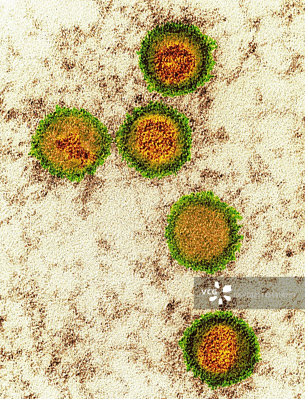 EB病毒颗粒（透射电镜）图片素材