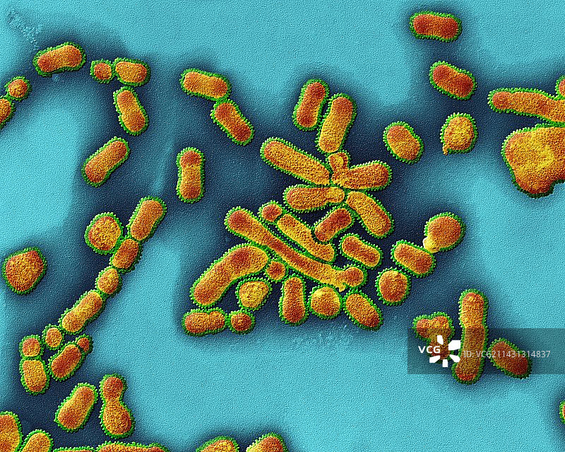 甲型流感病毒扫描电镜图图片素材