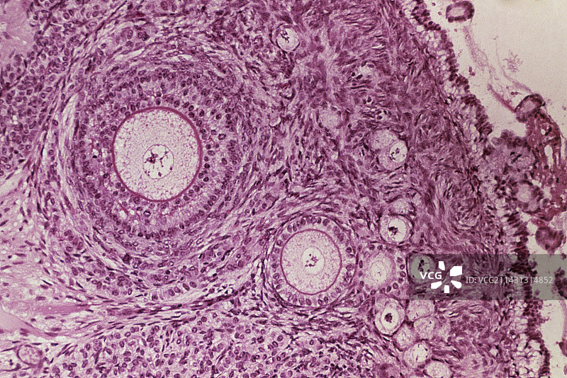 卵巢切片显微图像，显示卵泡图片素材