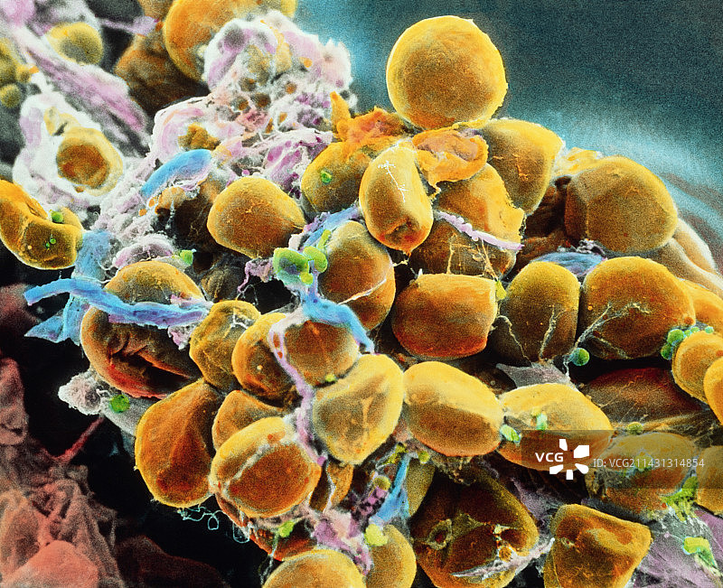 脂肪组织扫描电镜图图片素材