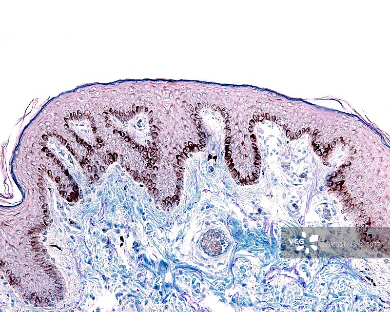 乳头皮肤显微照片图片素材