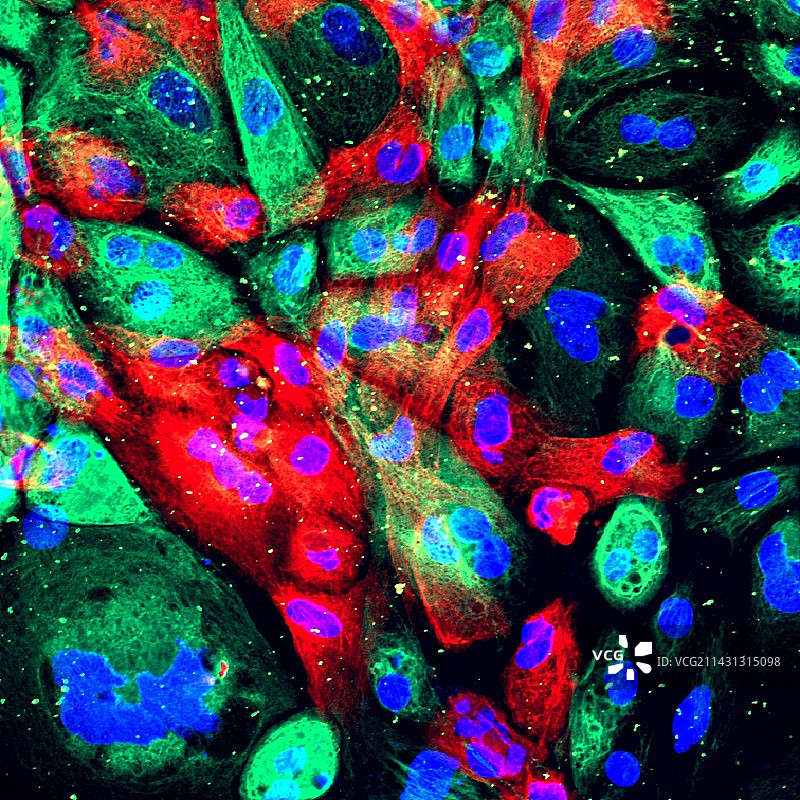 前列腺癌细胞荧光显微照片图片素材