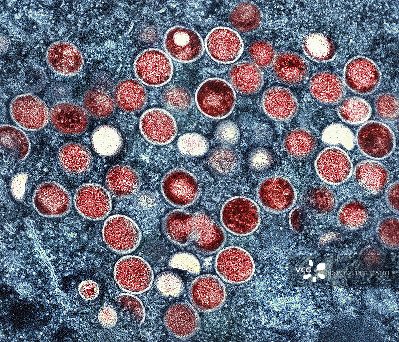 猴痘病毒颗粒,TEM图片素材