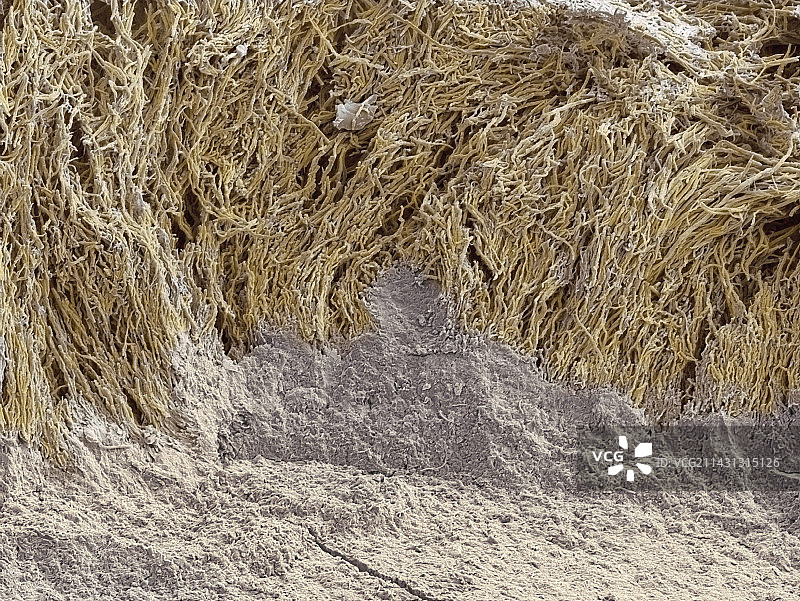 牙菌斑扫描电镜图图片素材