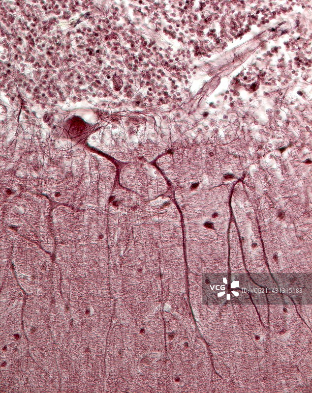 浦肯野神经元显微照片图片素材