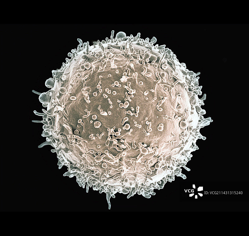人体B淋巴细胞扫描电镜图图片素材