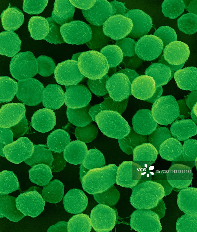 詹氏甲烷球菌古细菌，扫描电镜图片素材