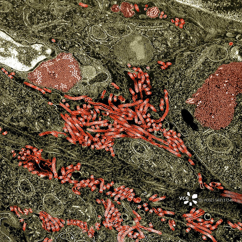 感染组织中的埃博拉病毒颗粒图片素材