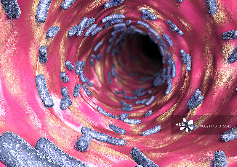 泌尿道感染图片素材