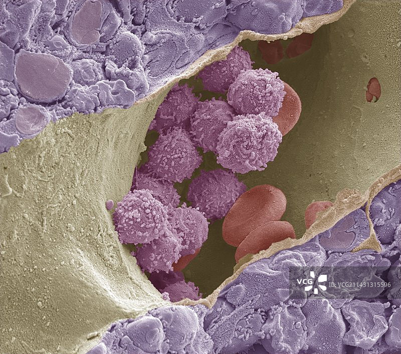 骨髓扫描电镜图图片素材