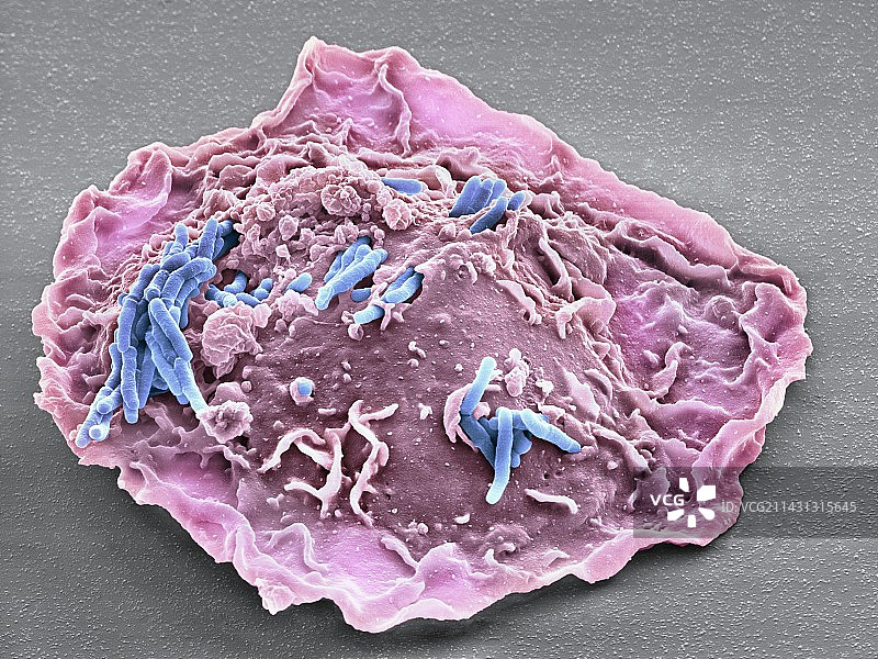 巨噬细胞吞噬结核杆菌扫描电镜图图片素材