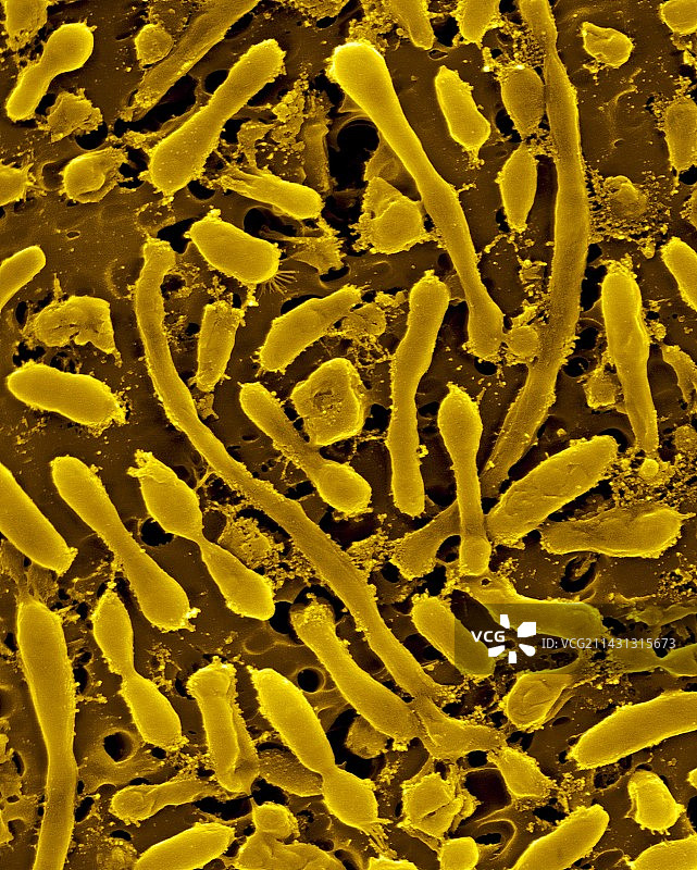 嗜盐古菌扫描电镜图图片素材