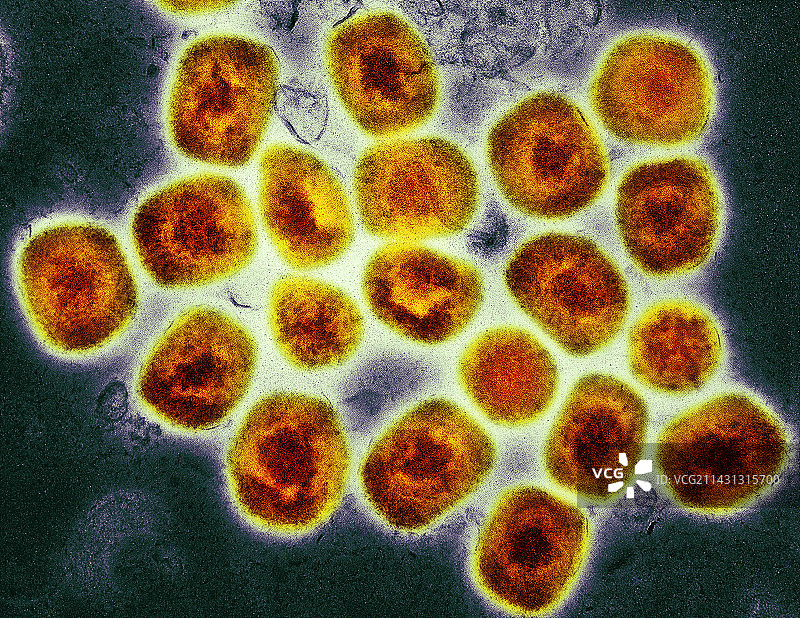 猴痘病毒颗粒，TEM图片素材