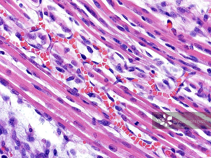 毛细血管，光学显微照片图片素材