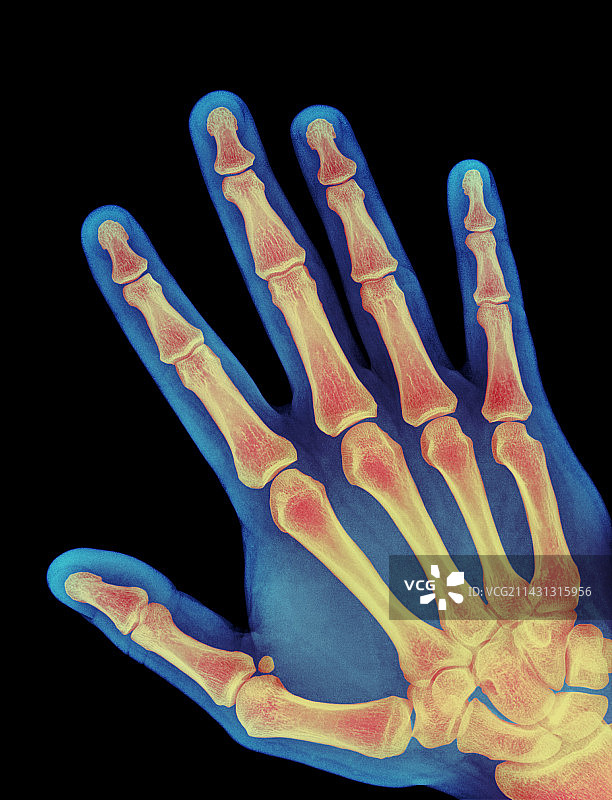 健康的成年人手部X光片图片素材
