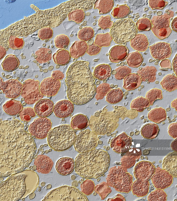 沙眼衣原体细菌，透射电镜图片素材