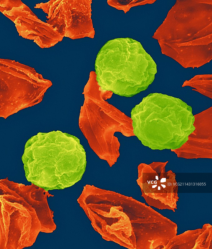 恶性疟原虫，扫描电镜图片素材