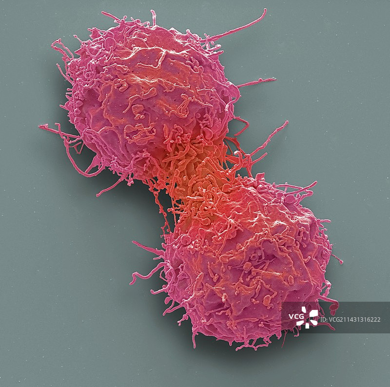 白血病细胞分裂，扫描电镜图片素材