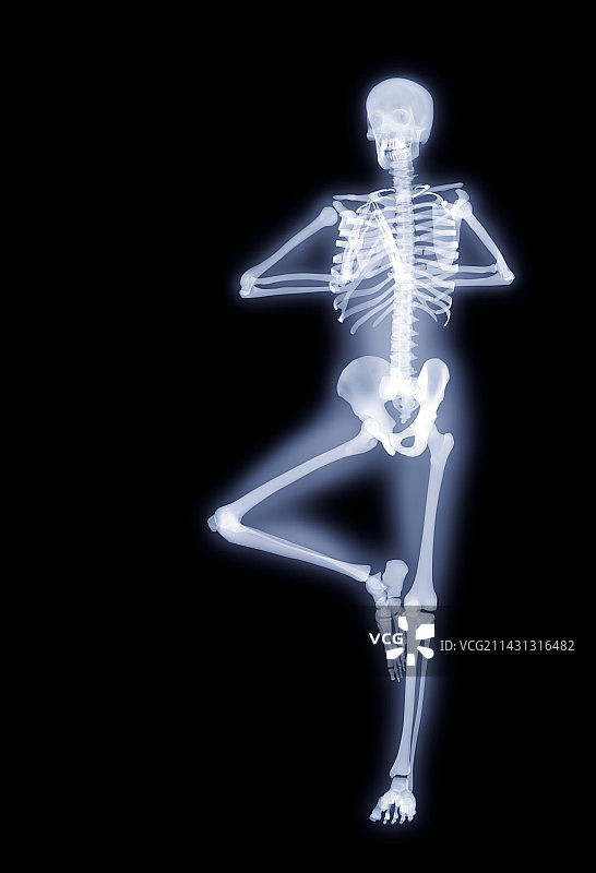 瑜伽体式X光图片素材