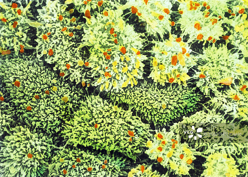 子宫颈管分泌细胞的彩色扫描电镜图像图片素材