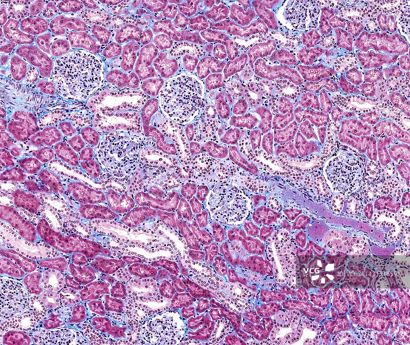 肾脏显微照片图片素材
